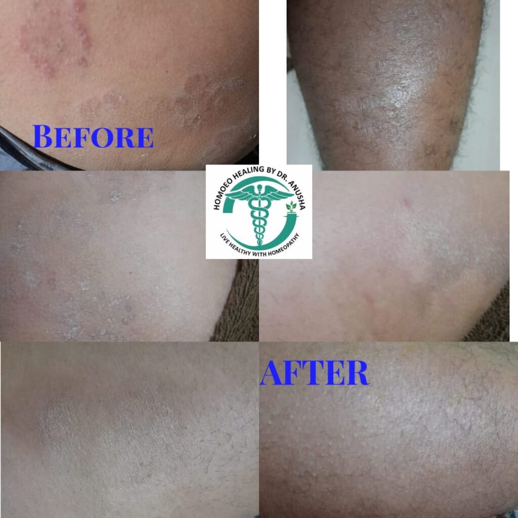 Dr Anusha Results